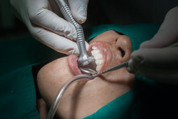 Dentistry. Dentists are using teeth to patients who have dental fillings.