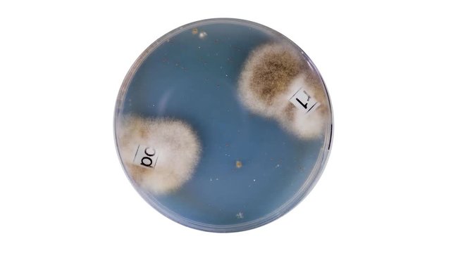Growing Bacterial Colonies In Petri Dish, Time Lapse
