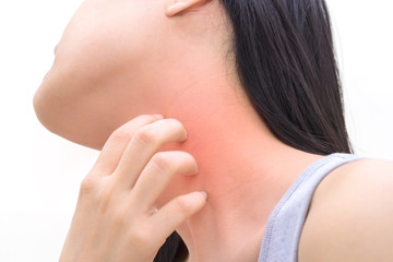 Woman has skin rash itch on neck