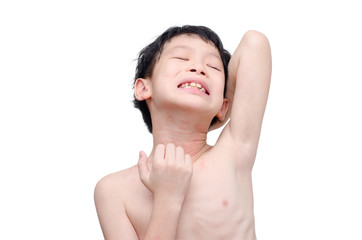 Young asian boy scratching his skin over white