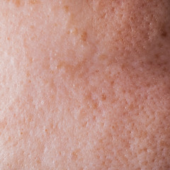 Fototapeta premium Human face skin texture