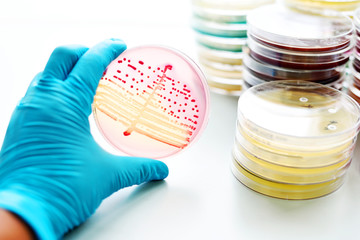 Bacteria culture in petri dish
