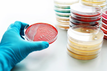 Bacteria culture in petri dish
