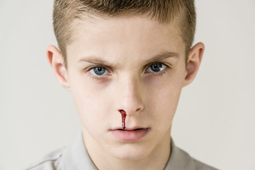 Blood trickles from nose of male child on grey