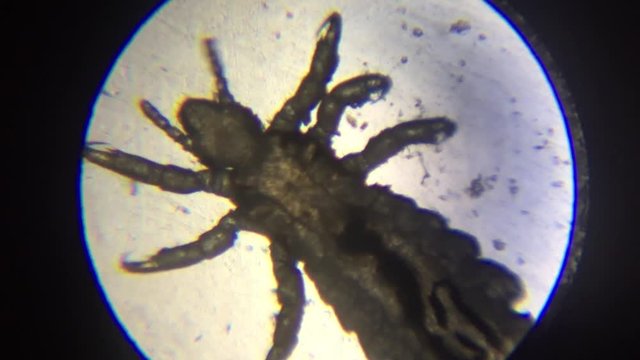 Lice inspected under the microscope