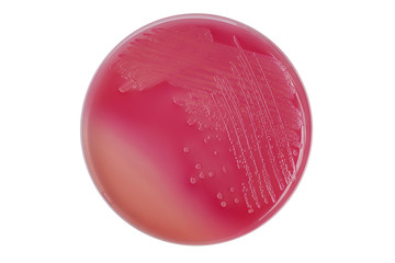 E.coli (Escherichia coli) bacterial colonies on MacConkey agar p