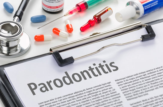 Parodentitis