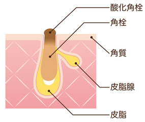 赤ニキビ ニキビの仕組み 毛穴の構造 Wall Mural Wallpaper Murals Koti