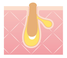 毛穴の構造　角栓　断面図