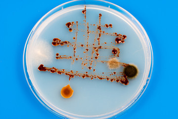 Petri dish in microbiological science laboratory