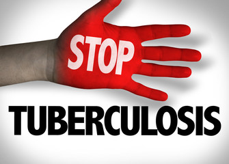 Stop Tuberculosis