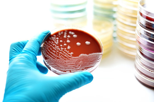 Colonies of bacteria in chocolate agar (culture medium plate)
