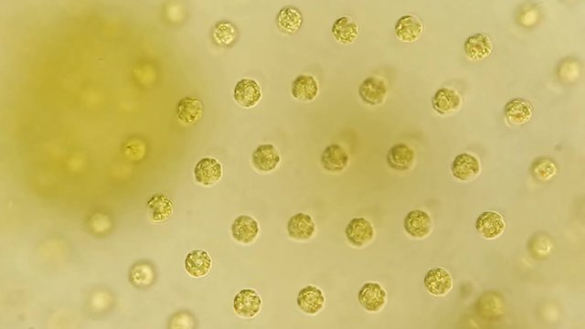 Green algae cells under microscope