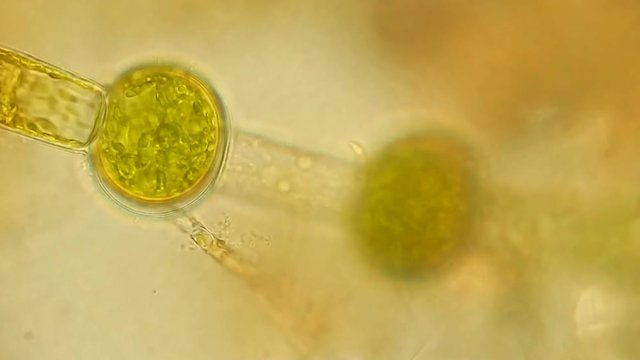 Green algae cells under microscope