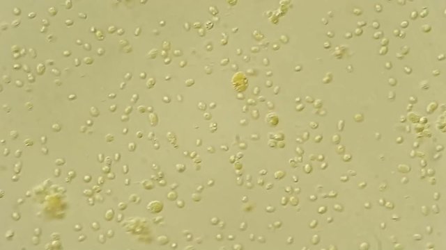 Green algae cells under microscope