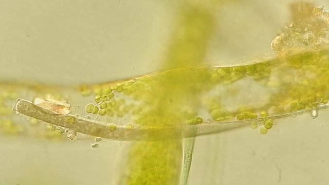 Seaweed (algae) under microscope, magnification 400x