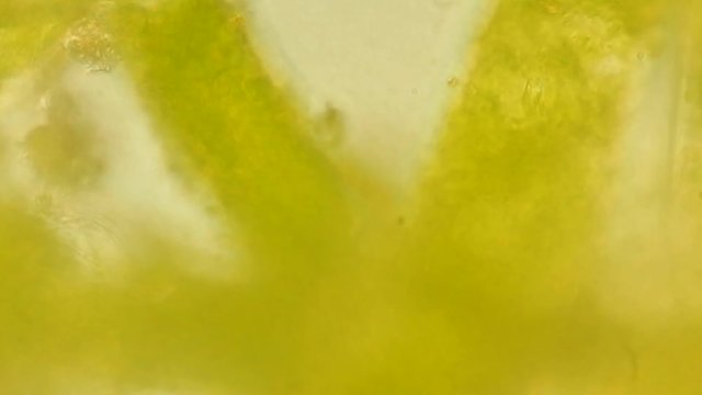 Seaweed (algae) under microscope, magnification 400x