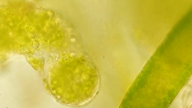 Seaweed (algae) under microscope, magnification 400x
