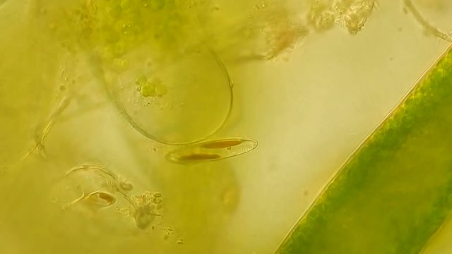 Seaweed (algae) under microscope, magnification 400x