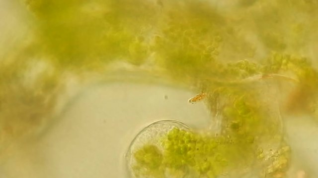 Seaweed (algae) under microscope, magnification 400x