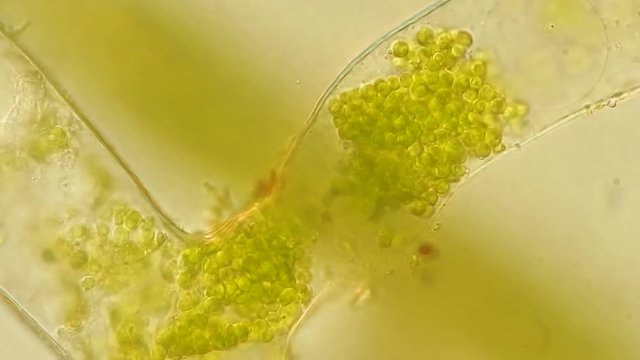 Seaweed (algae) under microscope, magnification 400x