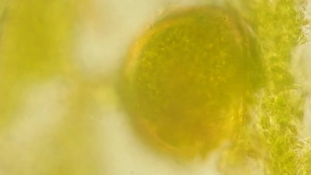 Seaweed (algae) under microscope, magnification 400x