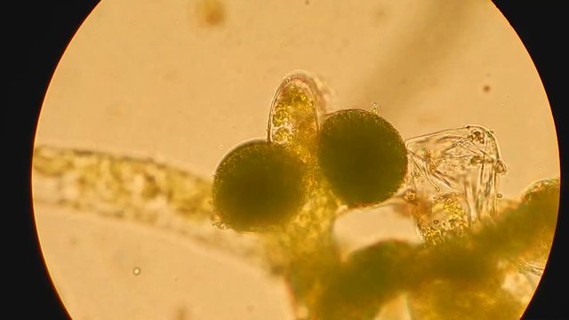 Seaweed (algae) under microscope, magnification 400x