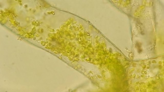 Seaweed (algae) under microscope, magnification 400x