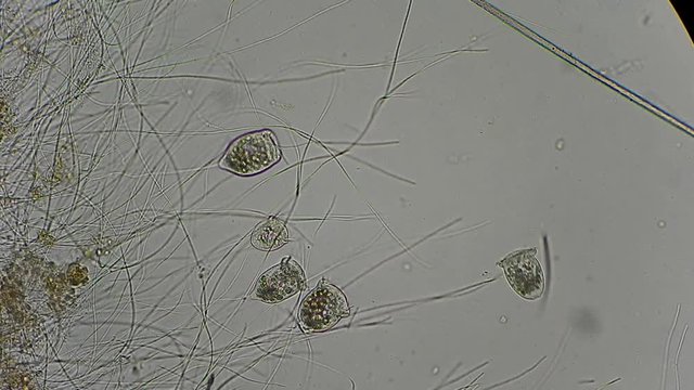 vorticella and rotifers filtrating water under microscope 400x