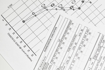 Hearing Test Chart with Graph