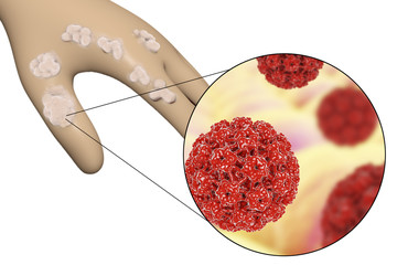 Bacteria Bacillus anthracis