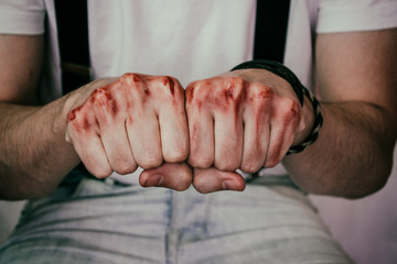 Puños de un hombre con sangre en los nudillos