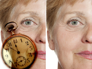  before - after