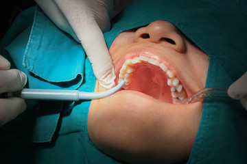 Dentistry, dental fillings are.