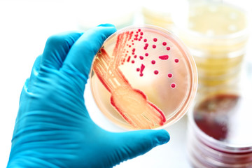 Colonies of bacteria in MacConkey agar 
