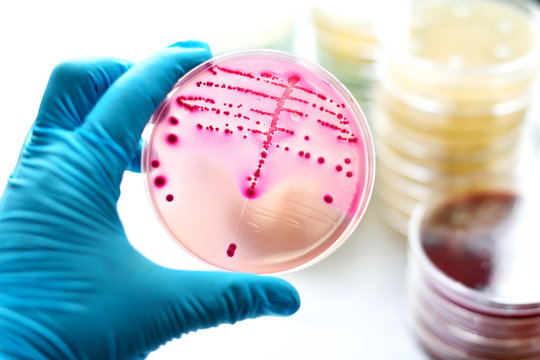 Colonies of bacteria in MacConkey agar 
