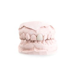 Denture