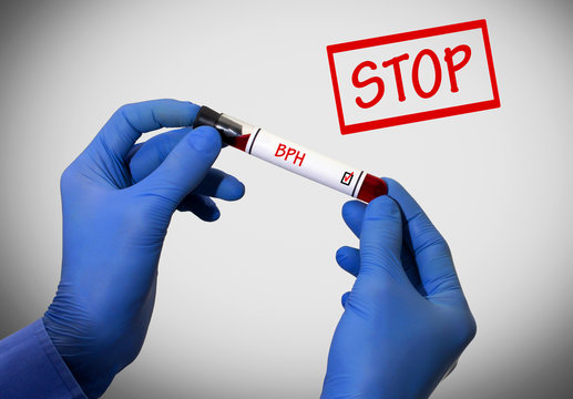 Stop BPH (benign prostatic hyperplasia)