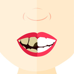 Comparison between healthy and rotten tooth. Face divided in half.