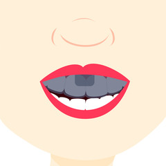 Smile and showing teeth with dental tray. Dental treatment.  Close up in the mouth.