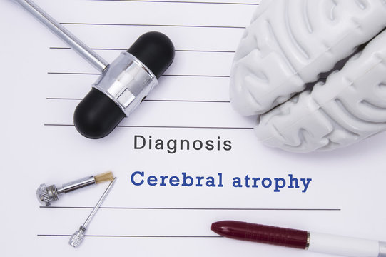 Diagnosis of Cerebral atrophy. Neurological hammer and brain figure lie on a medical  paper form with a heading diagnosis of Cerebral atrophy on a table in the office of a neurologist