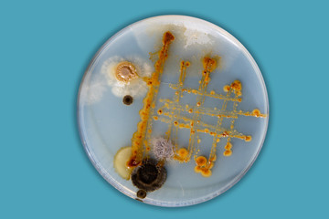 Pathogenic bacteria in petri dish