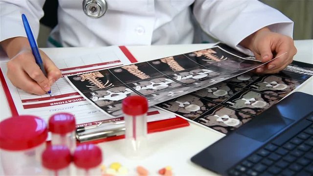 Woman Doctor Examines X-ray Scan And Writes The Data In A Medical Form