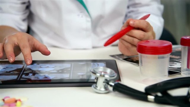 Doctor Examines An X-ray Images Of Patient On Touch Pad