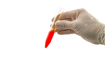 Doctor holding a bottle of blood sample isolated on white background.Saved with clipping path.