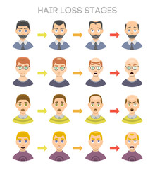 Baldness stages vector set.