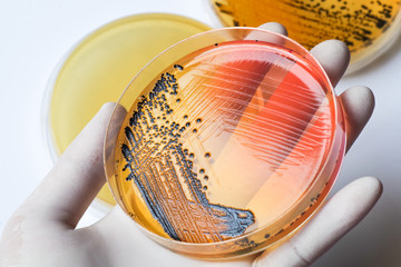 Scientist's hand in medical latex glove holding the bacteria colonies growing petri dish over bacteria plates background. Salmonella bacterial colonies on Salmonella-Shigella medium agar plate.