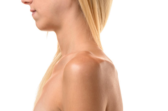 Collar bones of an undernourished woman