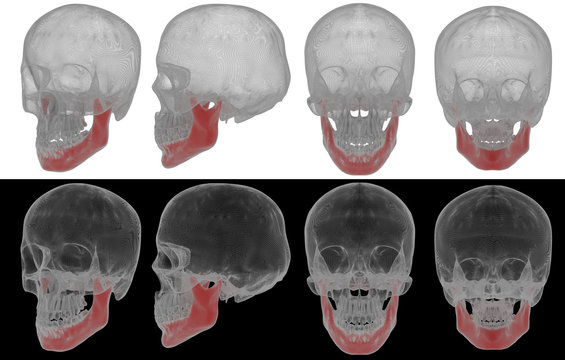 3d rendered illustration of jaw bone
