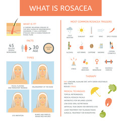 Rosacea: Causes, types, therapy and facts. Infographics